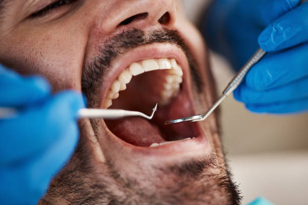 Best Urgent Tooth Repair  in Atwood, IL