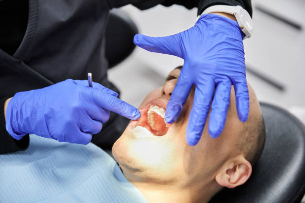 Best Chipped Tooth Repair Near Me  in Atwood, IL